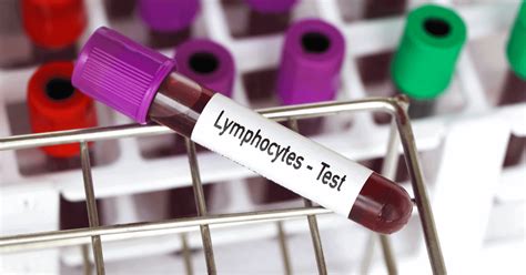 high cd19 count|Lymphocytosis: Definition, Causes, Symptoms & Treatment.